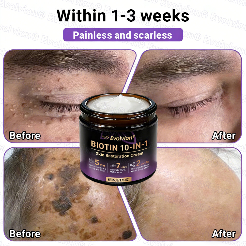 Made and Shipped from UK ✨Evolvion® Biotin 10-in-1 Skin Restoration Cream ☘️☘️☘️