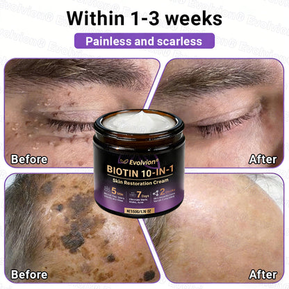 Made and Shipped from UK ✨Evolvion® Biotin 10-in-1 Skin Restoration Cream ☘️☘️☘️