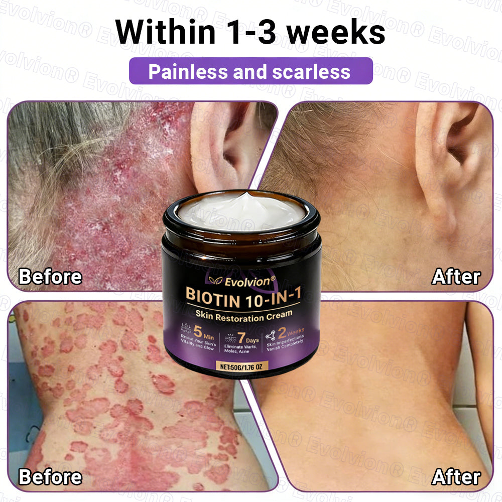 Made and Shipped from UK ✨Evolvion® Biotin 10-in-1 Skin Restoration Cream ☘️☘️☘️