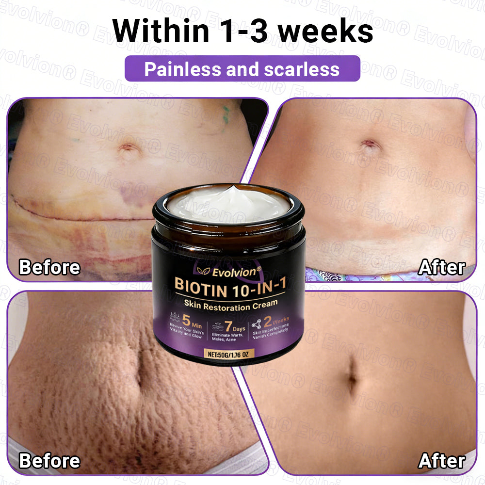 Made and Shipped from UK ✨Evolvion® Biotin 10-in-1 Skin Restoration Cream ☘️☘️☘️