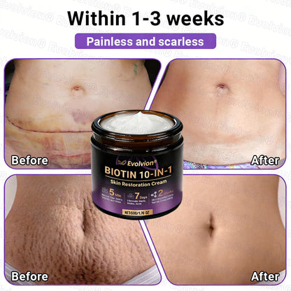 Made and Shipped from UK ✨Evolvion® Biotin 10-in-1 Skin Restoration Cream ☘️☘️☘️