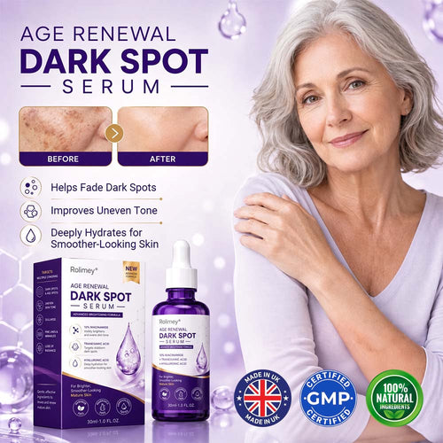 ✨ Rolimey® Age Renewal Dark Spot Serum — Infused with 10% Niacinamide, Tranexamic Acid & Hyaluronic Acid for Brighter, Smoother-Looking Mature Skin 🍀🍀