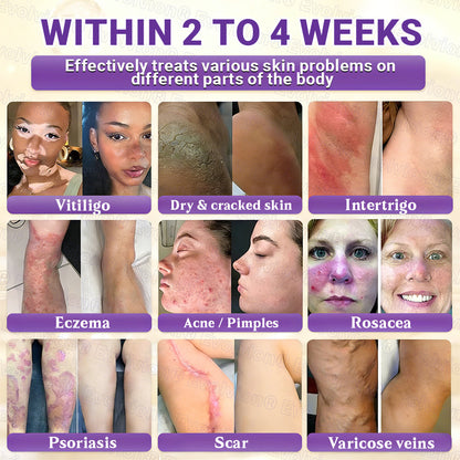 Made and Shipped from UK ✨Evolvion® Biotin 10-in-1 Skin Restoration Cream ☘️☘️☘️
