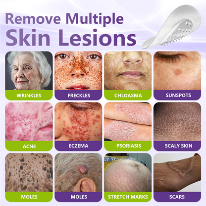 GFOUK® Soluble Microneedle Botanical Skin Tag Removal Patch🐞-up