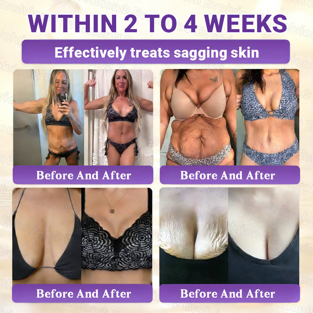 Made and Shipped from UK ✨Evolvion® Biotin 10-in-1 Skin Restoration Cream ☘️☘️☘️