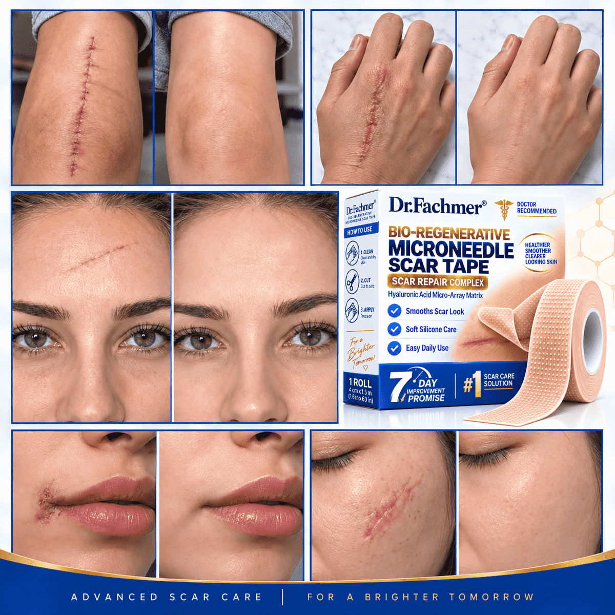 💎Dr.Fachmer® Bio-Regenerative Microneedle Scar Tape
