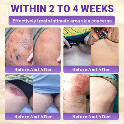 Made and Shipped from UK ✨Evolvion® Biotin 10-in-1 Skin Restoration Cream ☘️☘️☘️