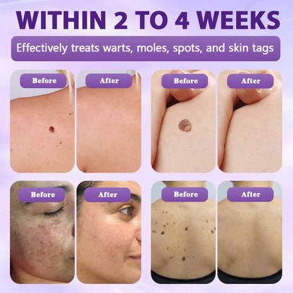 Made and shipped from the United Kingdom ✨Evolvion® Biotin 10-in-1 Skin Restoration Spray✨✨