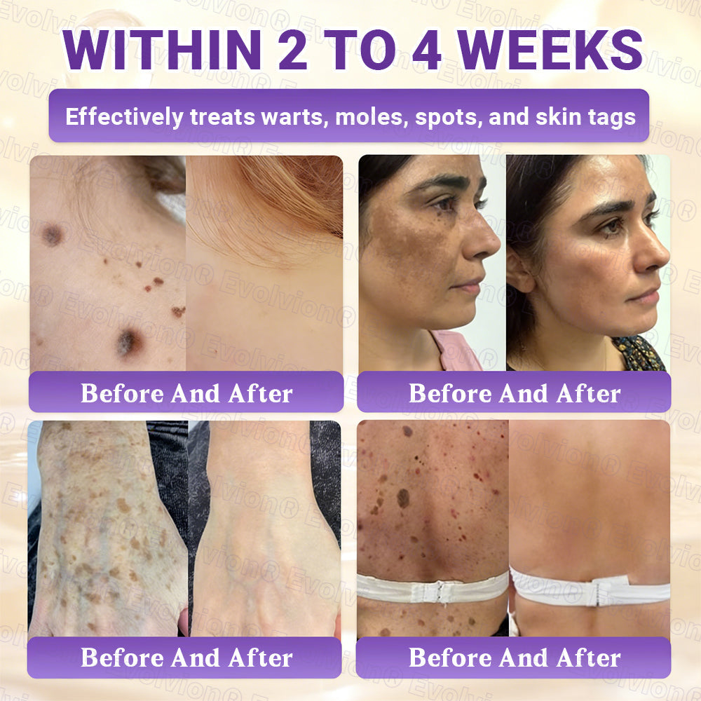 Made and Shipped from UK ✨Evolvion® Biotin 10-in-1 Skin Restoration Cream ☘️☘️☘️