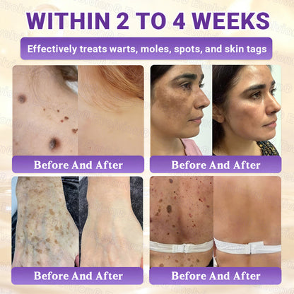Made and Shipped from UK ✨Evolvion® Biotin 10-in-1 Skin Restoration Cream ☘️☘️☘️