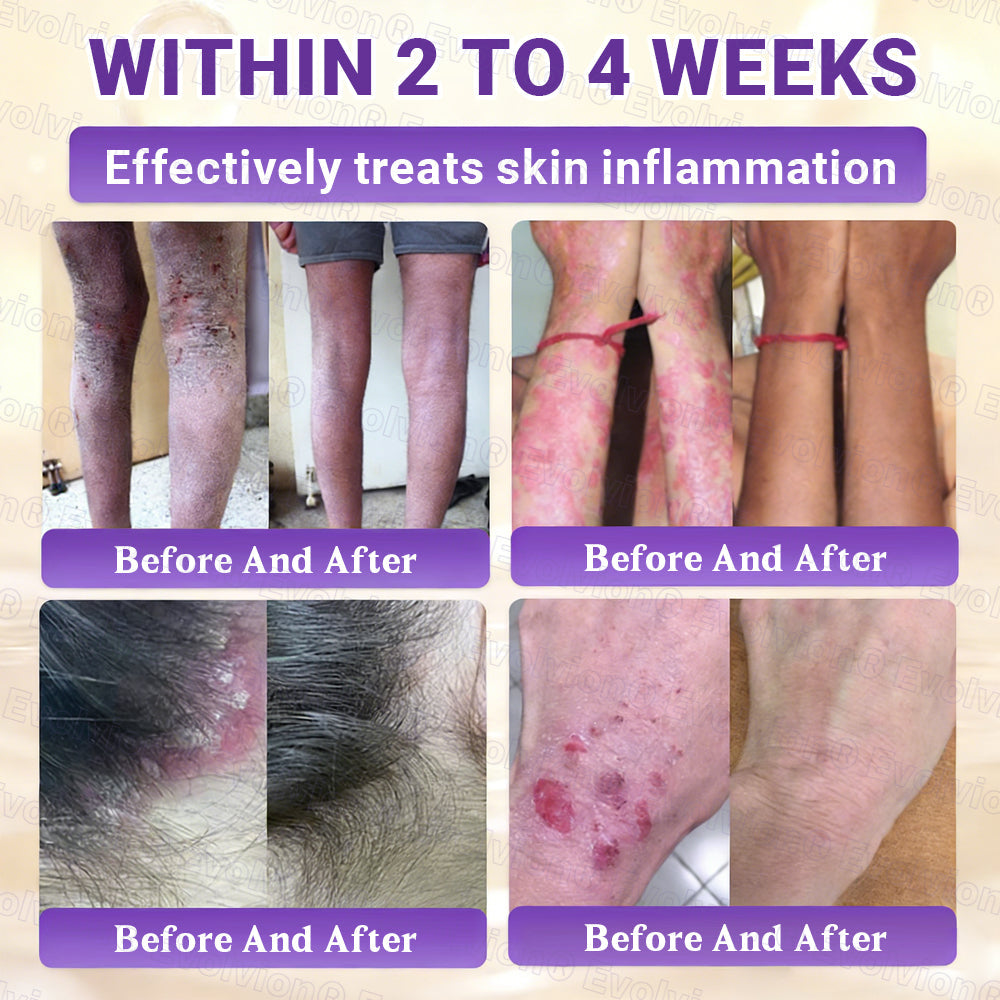 Made and Shipped from UK ✨Evolvion® Biotin 10-in-1 Skin Restoration Cream ☘️☘️☘️