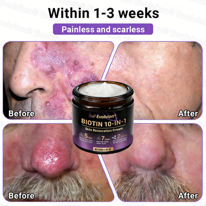 Made and Shipped from UK ✨Evolvion® Biotin 10-in-1 Skin Restoration Cream ☘️☘️☘️