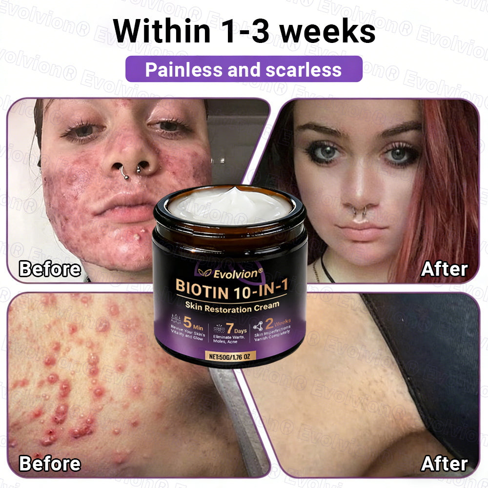 Made and Shipped from UK ✨Evolvion® Biotin 10-in-1 Skin Restoration Cream ☘️☘️☘️